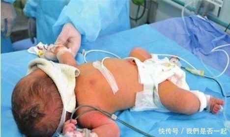 孕妇错把胎儿求救信号当做调皮，胎儿剖出来时，傻眼了