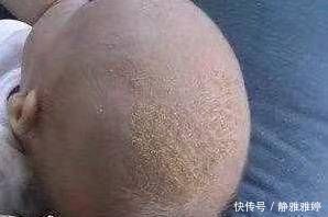 妈妈们|宝妈太爱干净了,出生15天后,她的孩子被送到了医院,医生责备宝妈无知