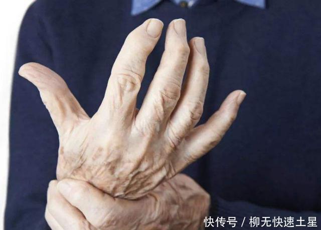 给尿酸高的人提个醒这4种食物比海鲜嘌呤还高,建议能避则避