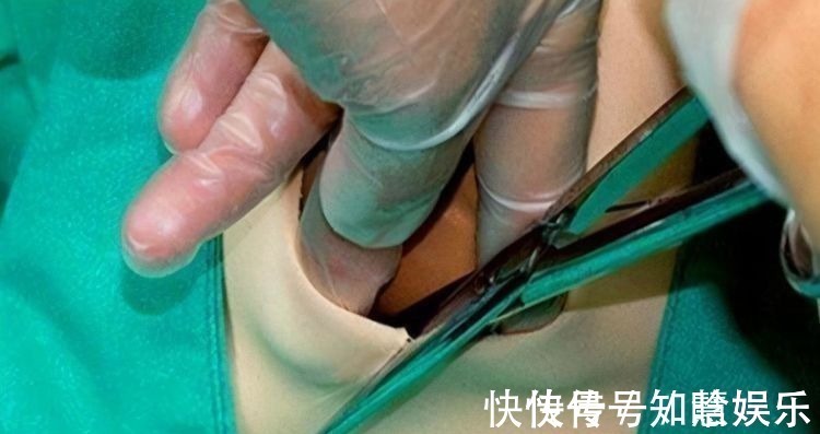 卫生巾|妈妈关于侧切的“五连问”,一步一步来解答,先马后看