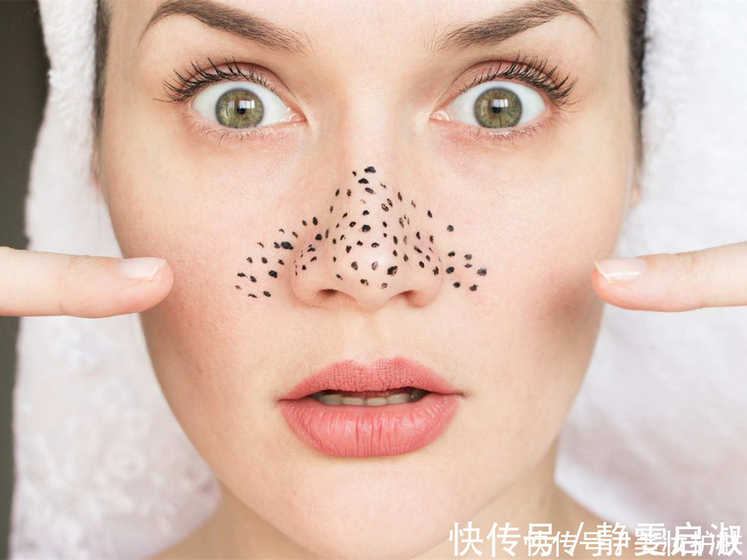 鼻子|怎样去掉鼻子上的黑头?这样做便宜又有效,而且不伤皮肤