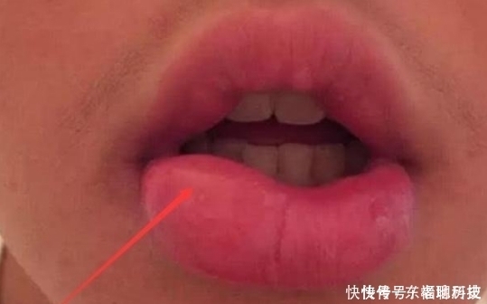 学生党“贼伤嘴巴”的3动作,多数00后已中招,变“火锅嘴”可别哭