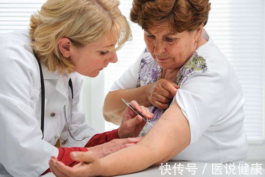 螺旋体|莱姆病的病程有快有慢,发现这5种情况,及时检查,切莫耽误病情