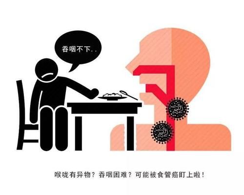  嗓子眼|总觉得嗓子眼有东西，咳又咳不出？医生：赶紧做胃镜