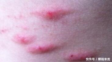 我们的生活|想知道有没有癌症, 看看身体这几个位置！