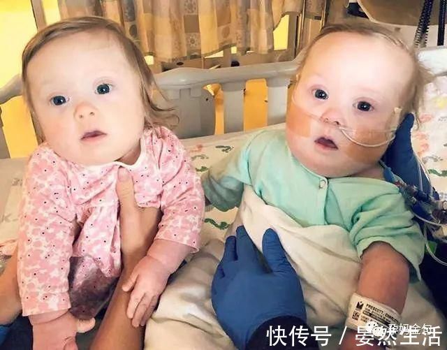 健康|怀孕后,怎么分辨宝宝是否健康?除了做“唐筛”,还有这四个方法