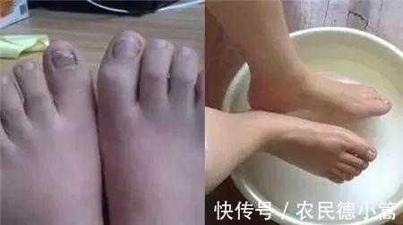 洗脸|白醋泡脚太厉害了，到现在才知道，学会你会感谢我！