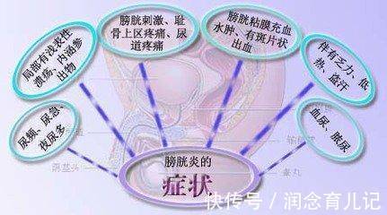 尿频|女性出现这些症状，一定要引起重视