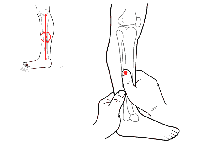 包包|孩子眼皮上长包,不痛不痒,一直消不下去?说明这里出了问题!