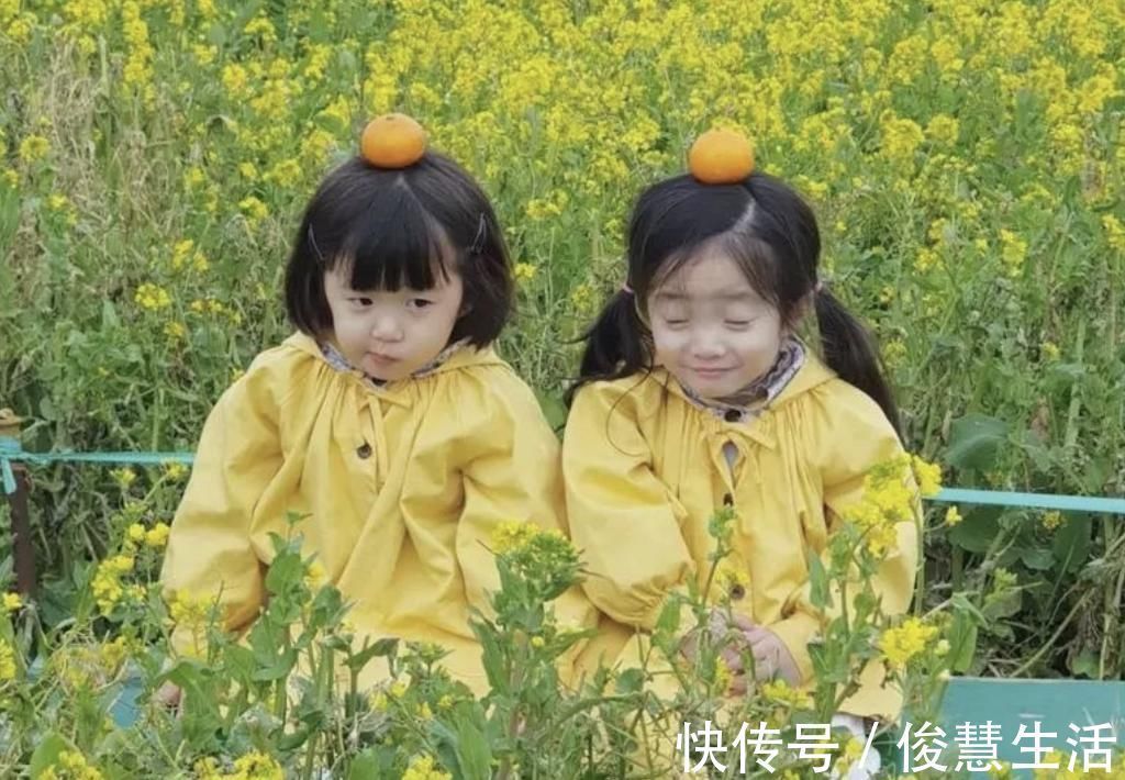 遗传物质|最好认的双胞胎走红,发量一个随妈一个随爸,网友:妈妈真偏心