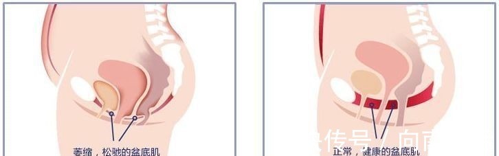 塑形|产后宝妈,这4点必须知道,否则产后修复必定效果不好