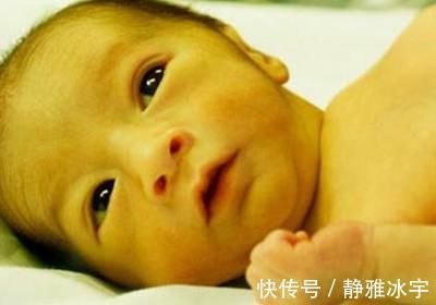 生理性黄疸|面对黄疸家里的老人说不需要太担心,黄疸如果不去管它会不会影响宝宝的智力?