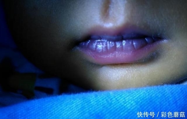 黏稠|血液粘稠的人,通常有5个表现,占2个以上,血管可能堵塞了