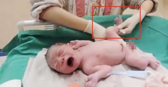 爸爸妈妈|宝宝出生后被带走十几分钟,这段时间经历了什么组图带你看真相!