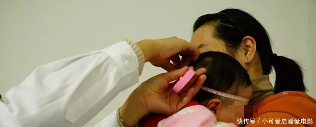 宝出生以后|囟门闭合的时间,对大脑发育有什么影响如果是第三种就该注意了