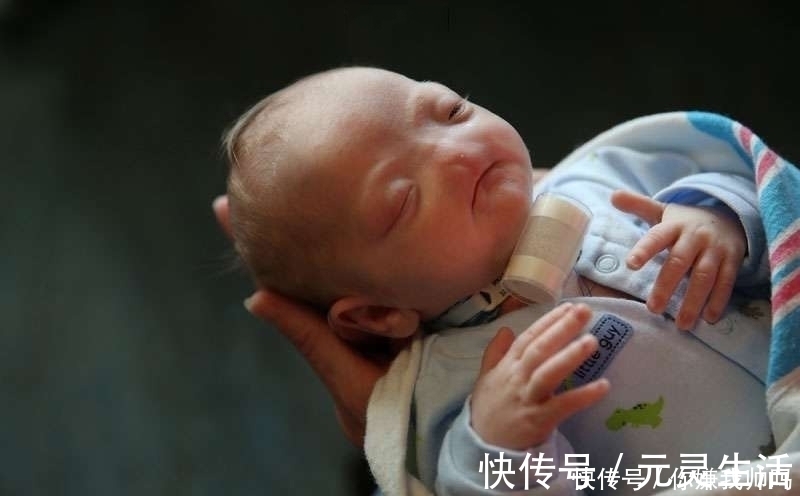 鼻子|小宝宝生下来就没鼻子,看到他笑再心痛也要忍着