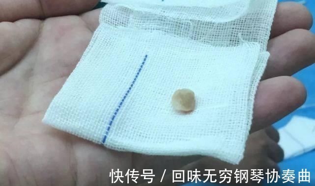 意外伤害|一个炒菜的功夫孩子就没了医生泣血忠告这些底线千万不要让孩子碰