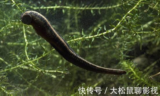 男孩|蚂蟥能在人体内长期存活吗?5岁男孩不小心吞进肚,1年后才发现