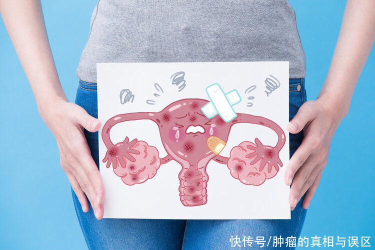 治疗|查出3种肿瘤不要慌，看起来吓人，一般都不需要手术和治疗