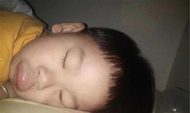 蚊虫|一觉醒来,儿子被蚊子咬成“香肠嘴”,妈妈心疼又不知所措