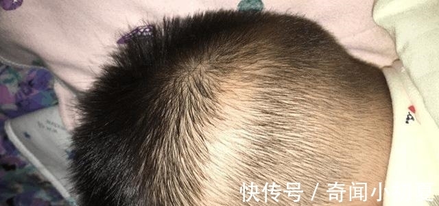宝宝|小宝宝为什么会出现枕秃?