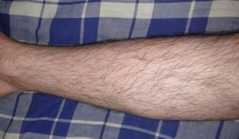 日常生活中|腿毛旺盛和没有腿毛的男人,两者有什么不同?医生说出了答案!