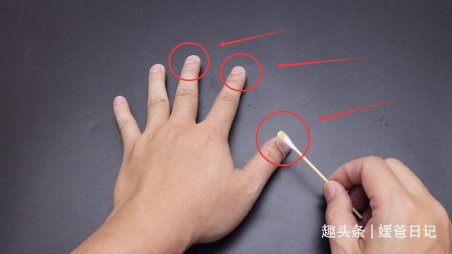 黄凡士林|红霉素软膏的5个作用,简单实用,回家找找有没有,试试