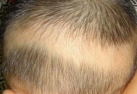 积食|12女孩连续6年睡前喝奶,一年身高仅长1.5cm,医生:无知