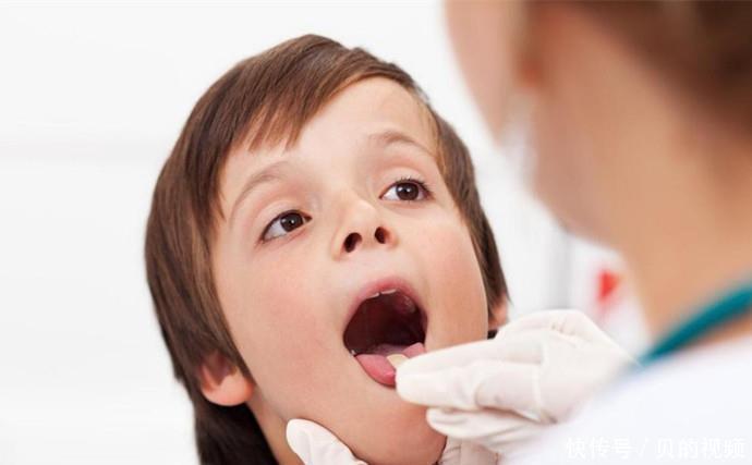 刷牙|儿子被同学嘲笑“嘴太臭”,带去医院检查后,取出的东西很恶心