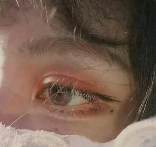 大眼睛|“异性缘”不好，原来是“眼睛太小”？学会3招，让你拥有“大眼睛”！