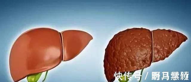 肝脏|肝病“最怕”1水,平时可劲喝,不出1个月,肝会“感激”你