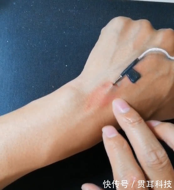 针管#为了请假实在是太拼了!美术生在手背上造假,看到成品老师笑了