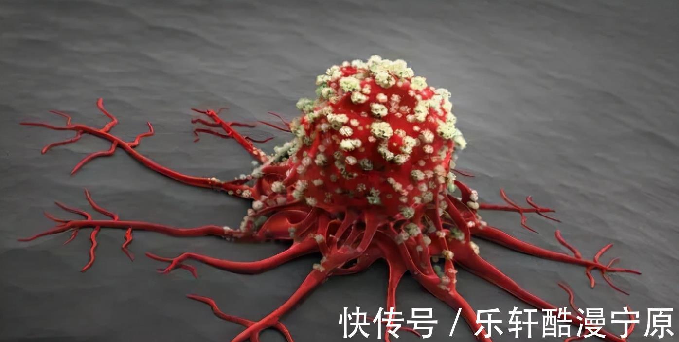 下身|女人身体2处“发痒”,注意是HPV来了,保护宫颈牢记这3点