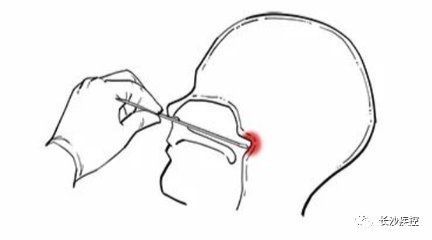 长沙|核酸检测为什么要采口鼻，不能采耳？长沙疾控专家告诉你原因