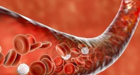 日常生活中|人体能否自动消除”血栓“?做好以下几件事,”血栓“形成不了