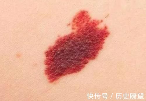 毒素|怀孕后的几件事一定要避免,为了孩子以后的容貌,再喜欢也要克制