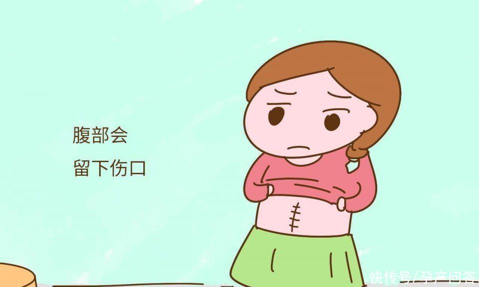 为什么现在女性都选择剖腹产？剖腹产和顺产的优缺点，一次性说清