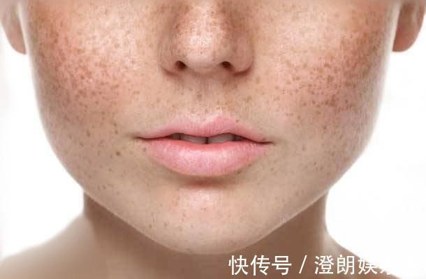 卵巢|子宫不好“全写在脸上”,头部有3个表现,说明你子宫已伤痕累累