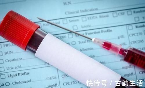 血脂|高血脂的“救命恩人”来了,多吃这3物,血脂乖乖降,血管软下来