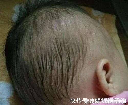 姥姥|6岁女孩积食不长个,“伤脾王”被揪出,大夫:这东西不能每天吃