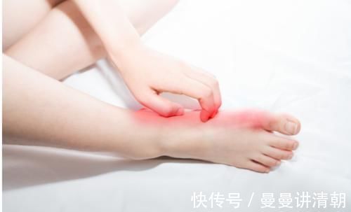 湿热|脚气痒、痒、痒!中医师:都是湿热惹的祸,简单一味药,帮你解决