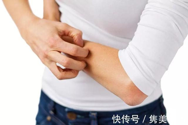 恶性肿瘤|癌症来临时，皮肤会出现4个变化，希望你可以及时知晓