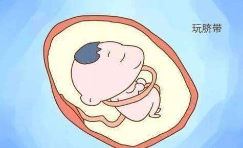 宝宝|四维总拍不到胎儿正脸?不想来回折腾,孕妈要提前做好这几点准备