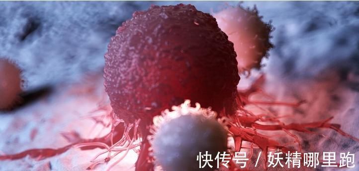 治疗|癌症晚期有多疼?甚至能够超过骨折!直接侵犯神经痛到生不如死