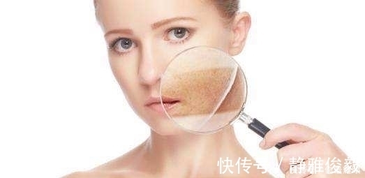 卵巢|女人雌性激素低，一般会有五个表现！女人味还算可以