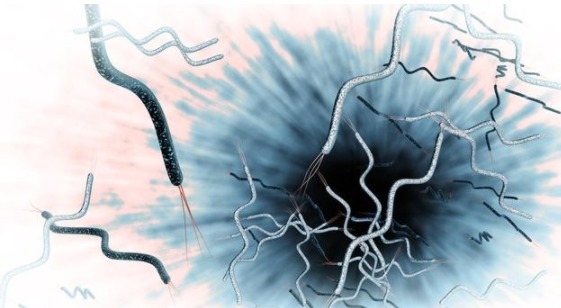 发病|癌症不是“瞬间”形成的，只要采取恰当措施，是可以预防和痊愈的