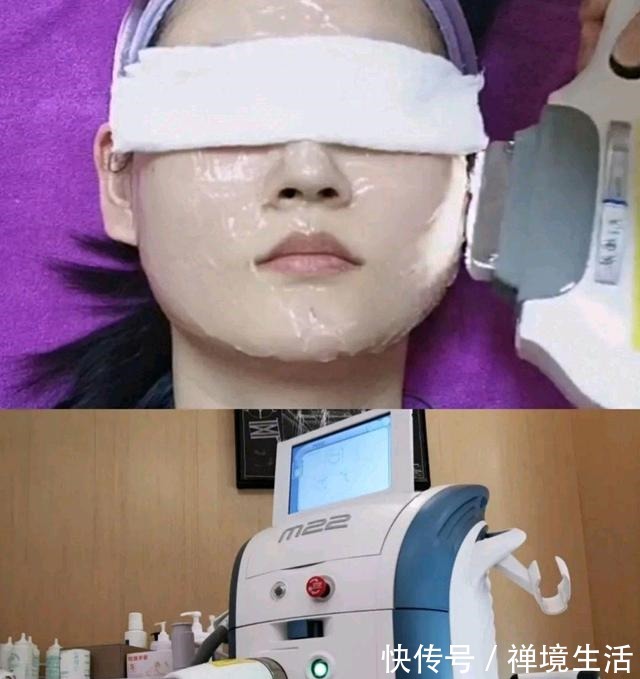 调皮 又去做光子嫩肤啦!真的是会上瘾!又去做光子嫩肤啦!真的是会上瘾!