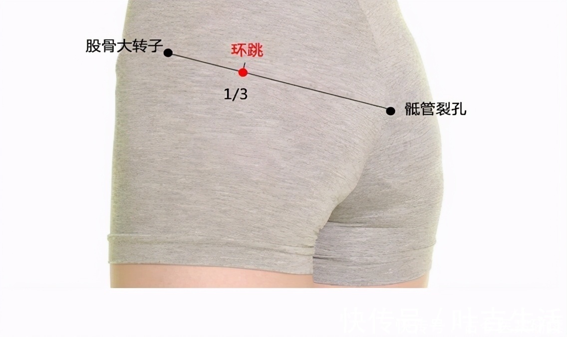 要穴|环跳穴,髋部及下肢疼痛的要穴;医生说:有三个功效,一个待验证