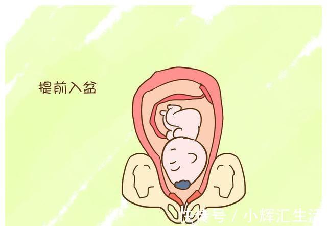 胎儿|孕晚期常做4个动作，胎儿入盆快分娩少遭罪