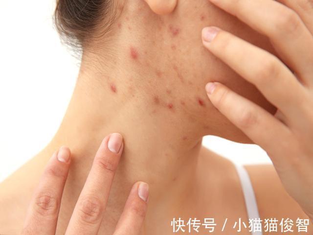 藏毒|肝脏“解毒高手”就在身边,保温杯里常备点,排毒养肝,肝无忧